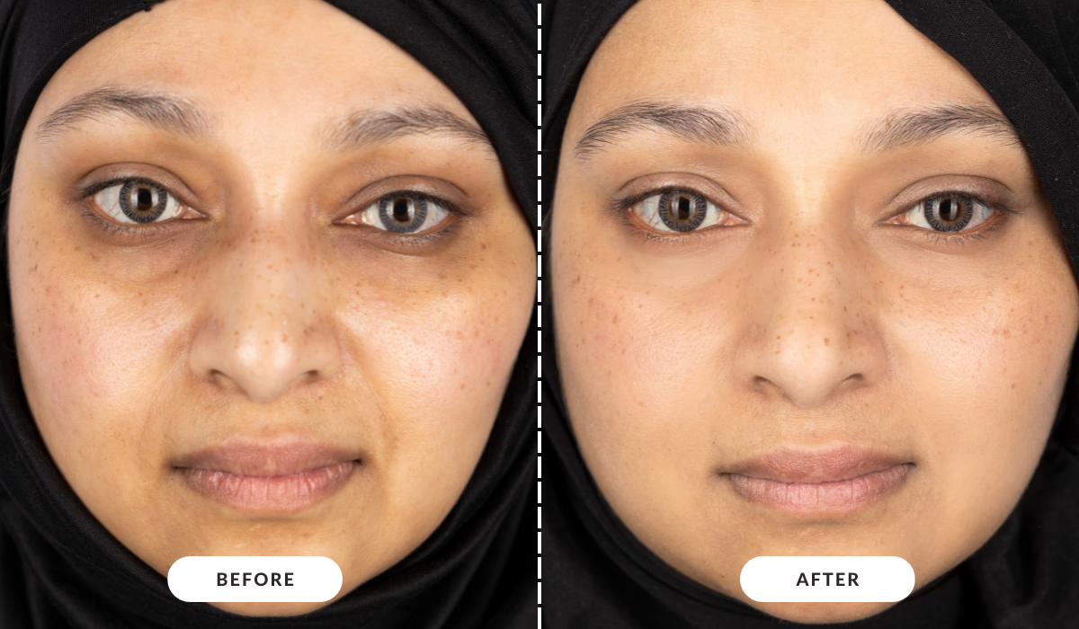 1_2_93c34546-9b66-49e9-9f45-1a848363f50b