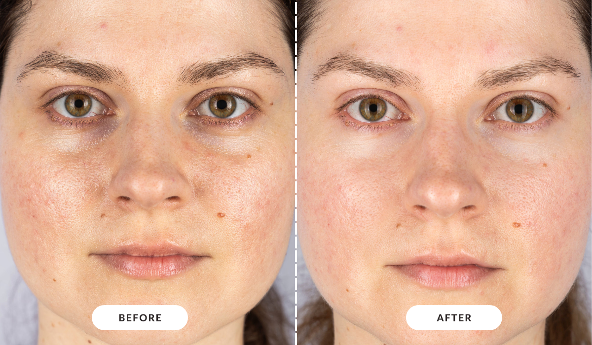 1_a623fb4c-a44a-48b3-868b-c5ec94da2525