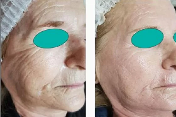 benefits-for-the-beautician